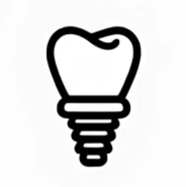 Implantes Dentários